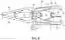 Fig. 19 - Surgical access system and related methods