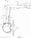 Fig. 20 - Surgical access system and related methods