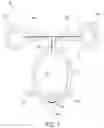 Fig. 02 - MONOFILAMENT SUTURE ANCHOR