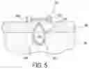 Fig. 06 - MONOFILAMENT SUTURE ANCHOR