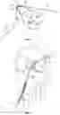 Fig. 06 - Surgical fixation systems and methods