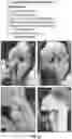 Fig. 28 - Surgical fixation systems and methods
