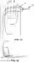 Fig. 02 - Surgical device for complex suturing fibrous tissues
