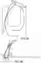 Fig. 03 - Surgical device for complex suturing fibrous tissues