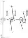 Fig. 08 - Surgical device for complex suturing fibrous tissues