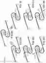 Fig. 09 - Surgical device for complex suturing fibrous tissues
