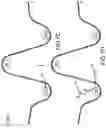 Fig. 17 - Surgical device for complex suturing fibrous tissues