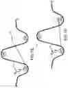 Fig. 18 - Surgical device for complex suturing fibrous tissues