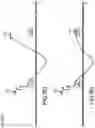 Fig. 24 - Surgical device for complex suturing fibrous tissues