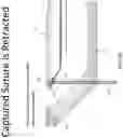 Fig. 61 - Method and apparatus for treating a hip joint, including the provision and use of a novel suture passer