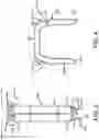 Fig. 03 - Variable Compression Bone Staple System