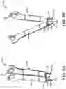 Fig. 04 - Variable Compression Bone Staple System