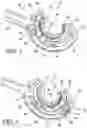 Fig. 03 - METHOD FOR SUTURE LACING