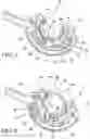 Fig. 04 - METHOD FOR SUTURE LACING