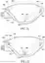 Fig. 11 - METHOD FOR SUTURE LACING