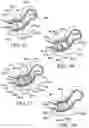 Fig. 25 - METHOD FOR SUTURE LACING