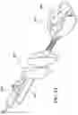 Fig. 27 - METHOD FOR SUTURE LACING