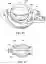 Fig. 37 - METHOD FOR SUTURE LACING