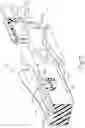 Fig. 04 - Decoupling mechanism for linear surgical stapler