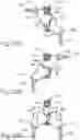 Fig. 22 - Decoupling mechanism for linear surgical stapler