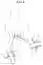 Fig. 03 - Stent for anastomosis of different kinds of organs
