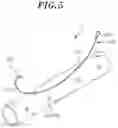 Fig. 06 - Stent for anastomosis of different kinds of organs