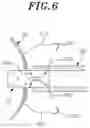 Fig. 07 - Stent for anastomosis of different kinds of organs