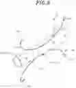 Fig. 10 - Stent for anastomosis of different kinds of organs