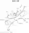 Fig. 11 - Stent for anastomosis of different kinds of organs