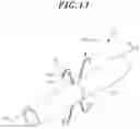 Fig. 12 - Stent for anastomosis of different kinds of organs