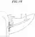Fig. 20 - Stent for anastomosis of different kinds of organs
