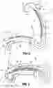 Fig. 04 - Ligation clip with improved hinge