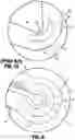 Fig. 06 - Ligation clip with improved hinge