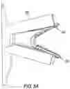 Fig. 07 - Surgical clip for simultaneous bleeding control of a blood vessel and cutting