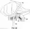 Fig. 08 - Surgical clip for simultaneous bleeding control of a blood vessel and cutting