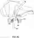 Fig. 09 - Surgical clip for simultaneous bleeding control of a blood vessel and cutting