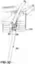 Fig. 10 - Surgical clip for simultaneous bleeding control of a blood vessel and cutting
