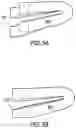 Fig. 15 - Surgical clip for simultaneous bleeding control of a blood vessel and cutting