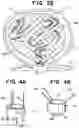 Fig. 06 - Delivery system for embolic braid