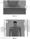 Fig. 10 - Methods and devices for reducing pressure