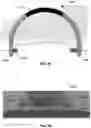Fig. 12 - Methods and devices for reducing pressure