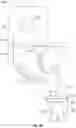 Fig. 08 - Laser assisted surgical resection alignment guide