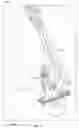 Fig. 13 - Laser assisted surgical resection alignment guide