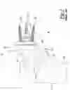 Fig. 03 - Patient-specific glenoid guides