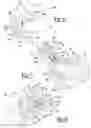 Fig. 06 - Patient-specific glenoid guides