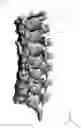 Fig. 02 - Device for fixing spine