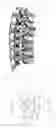 Fig. 03 - Device for fixing spine