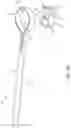 Fig. 02 - System for Articular Surface Replacement