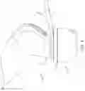 Fig. 06 - System for Articular Surface Replacement