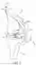Fig. 07 - System for Articular Surface Replacement